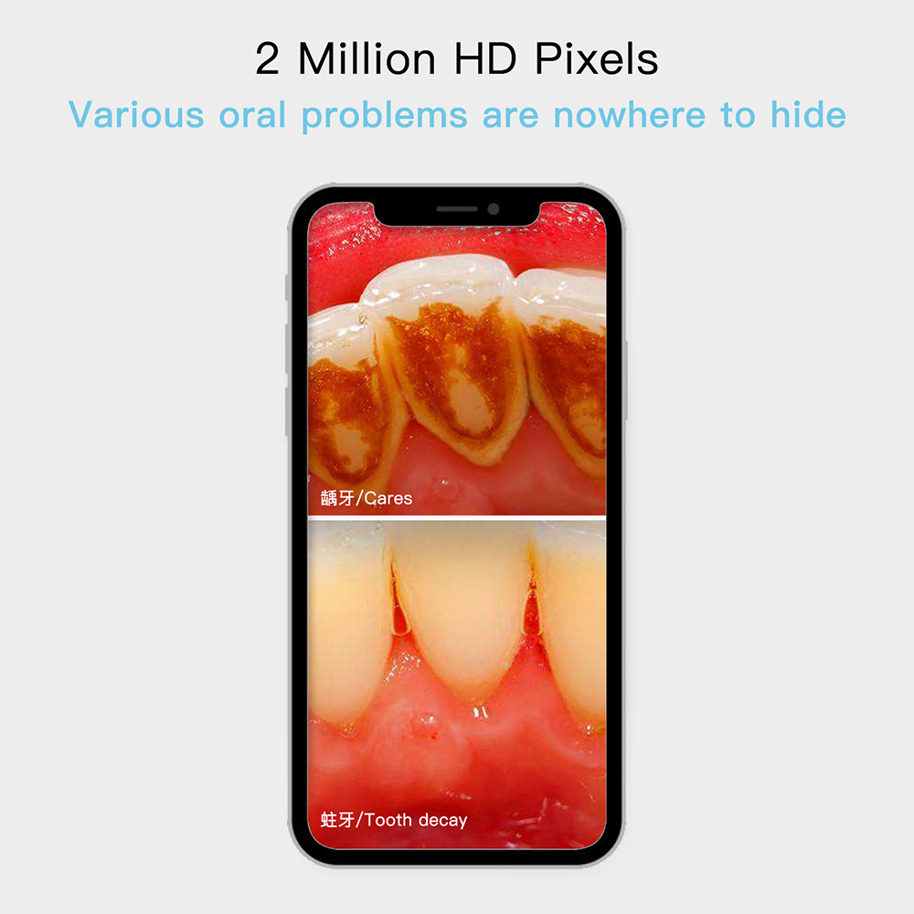 câmera de dentes full hd oral dental cam