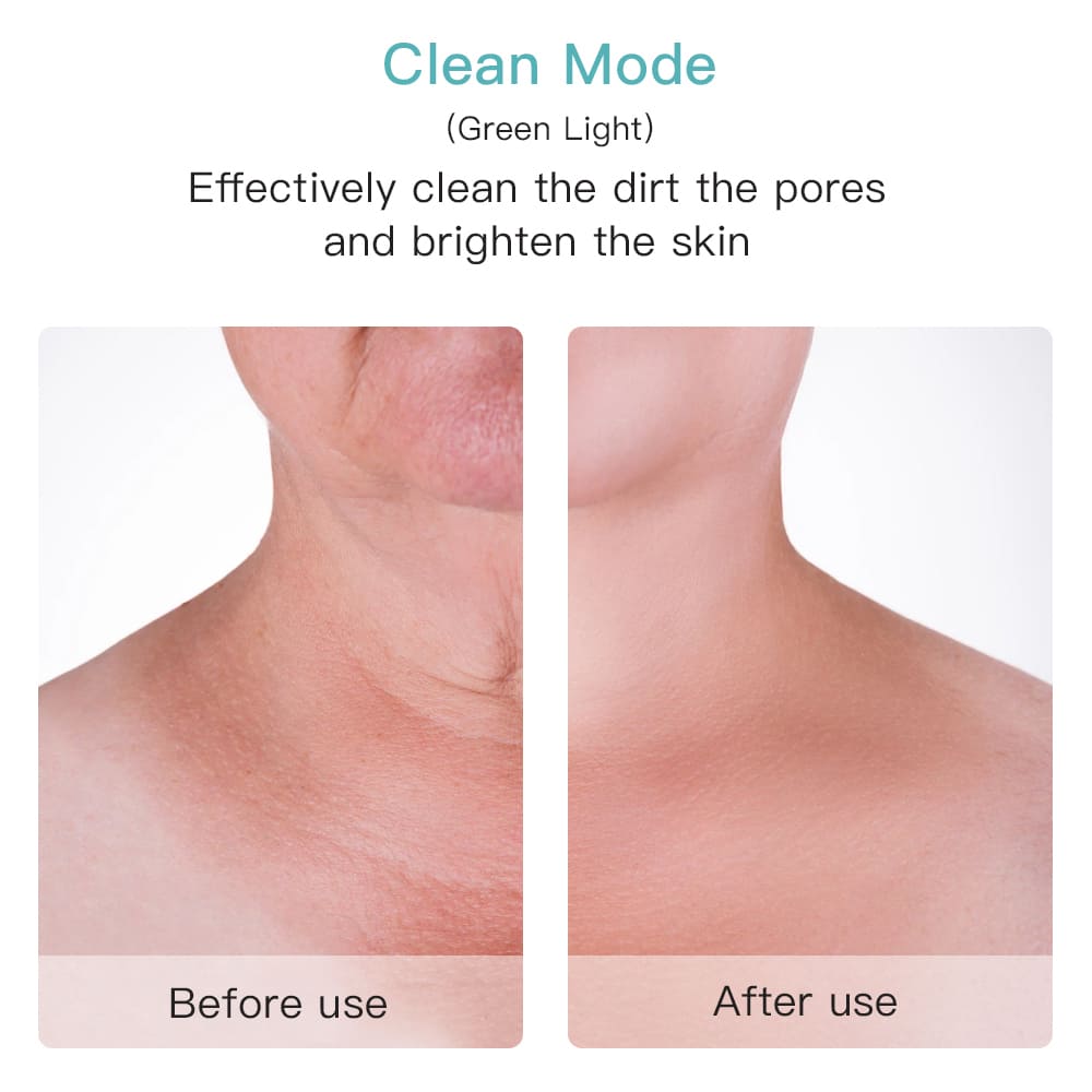 Limpador de poros eficaz no rosto ou pescoço antes depois